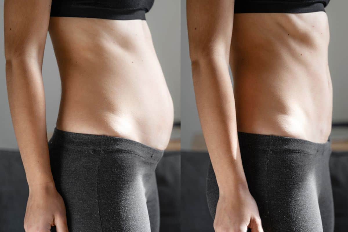Post-Pregnancy: What Happens to Your Abdominal Muscles After Birth Wimbledon