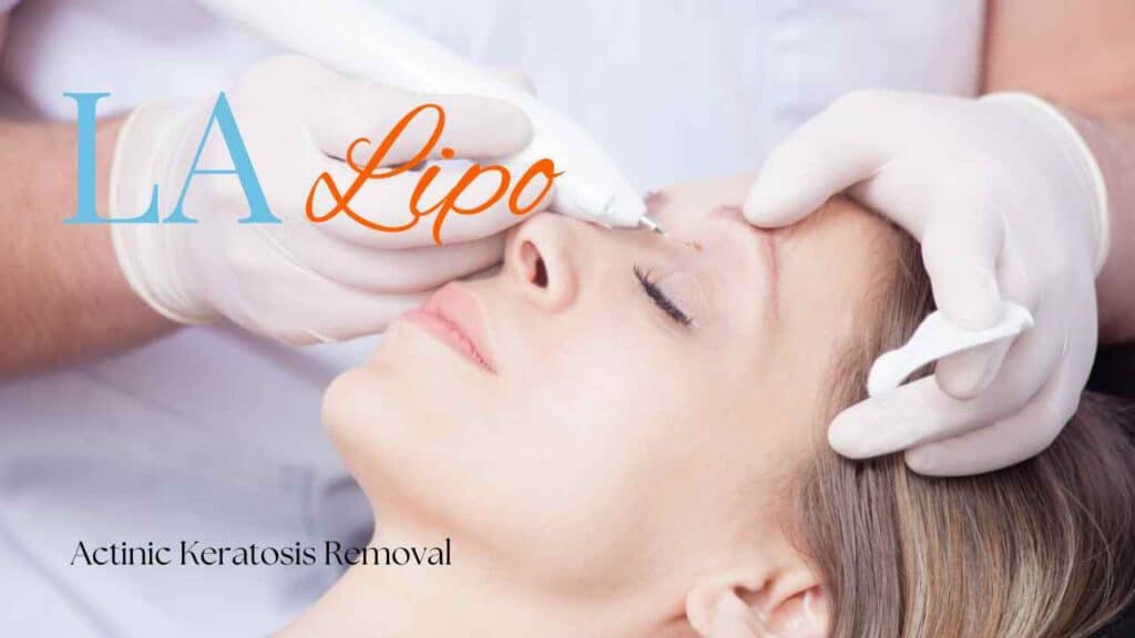 actinic keratosis removal Wimbledon