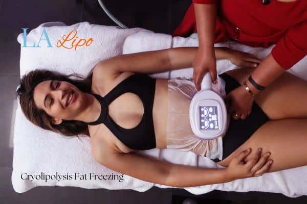 woman getting cryolipolysis Wimbledon