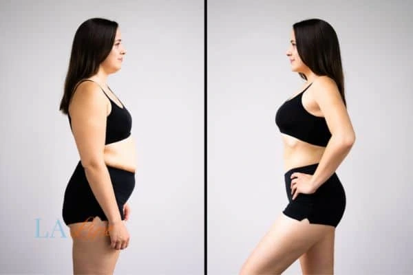 LA-EMS Body Sculpting Wimbledon results before and after of womans results on body toning.