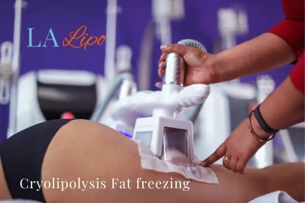 women getting fat freezing Wimbledon