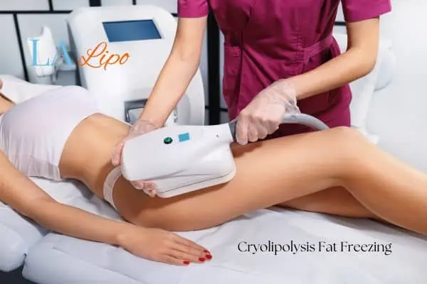 Woman receiving coolsculpting Wimbledon treatment on her thighs