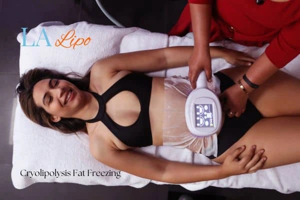 woman getting cryolipolysis Wimbledon