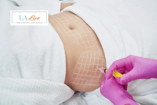 aqualyx fat dissolving injections Wimbledon
