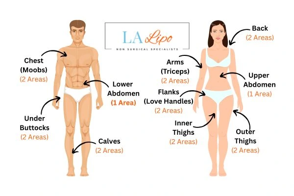 LA LIPO Cryolipolysis Areas Wimbledon