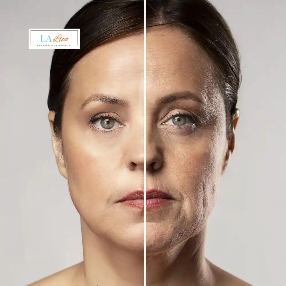 How Can You Tell If Non-Surgical Skin Tightening Is Right for You Wimbledon?