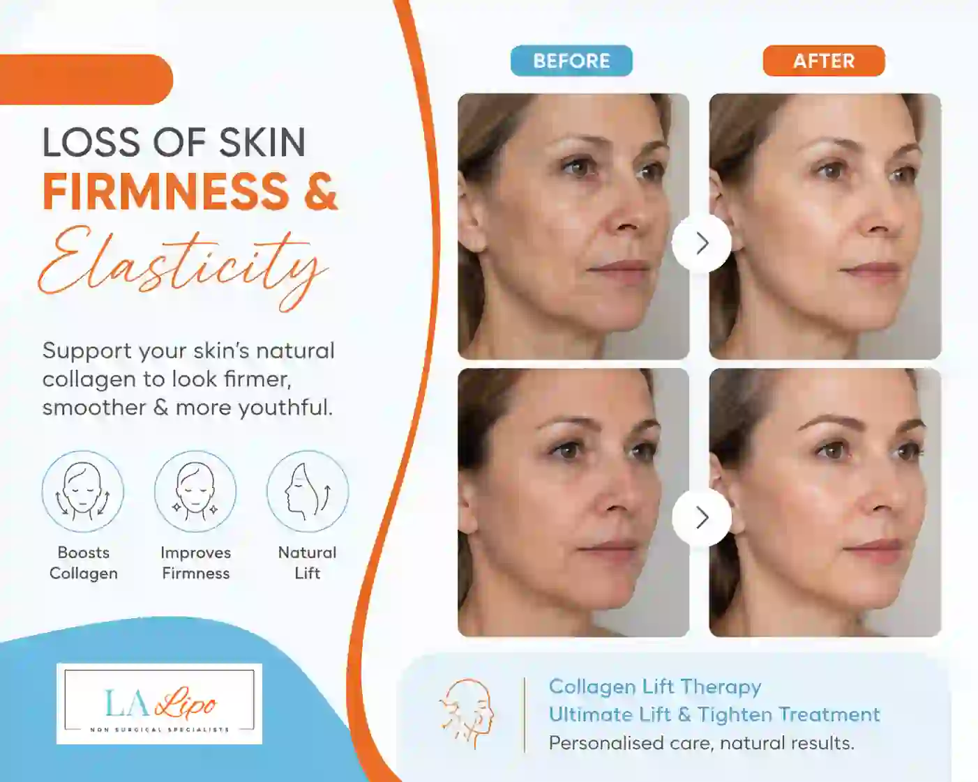 Sign #7: Loss of Skin Firmness and Elasticity Wimbledon