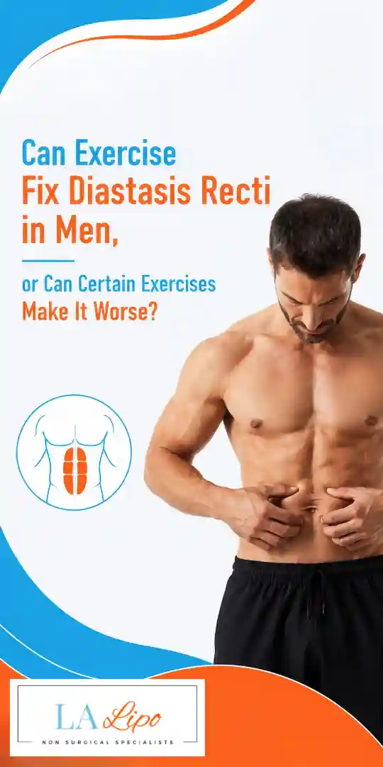 Can Exercise Fix Diastasis Recti in Men, or Can Certain Exercises Make It Worse Wimbledon?
